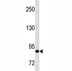 MMP9 antibody western blot analysis in CEM lysate. Predicted molecular weight: 92/67-80 kDa (precurs