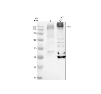 Western blot analysis of SETX using anti-SETX antibody. Electrophoresis was performed on a 8% SDS-PA