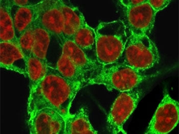 Immunofluorescent staining of methanol-fixed HepG2 cells with Glypican-3 antibody (green, clone SGPN