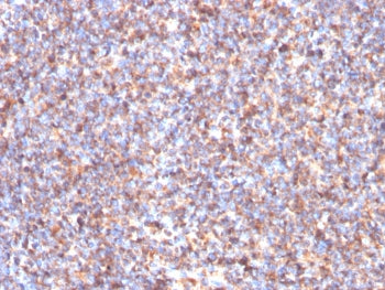 SDHB Antibody / Succinate dehydrogenase B