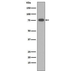 Western blot testing of the membrane fraction of human sera lysate with VTN antibody. Expected molec