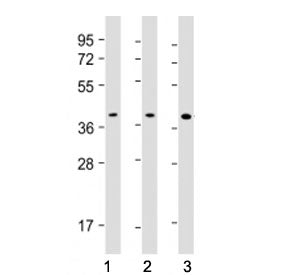 Western blot testing of PU.1 antibody at 1:500: Lane 1) human K562, 2) Daudi and 3) THP1 cell lysate