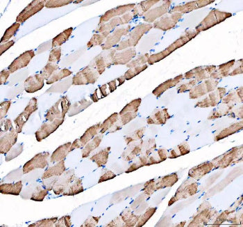 Immunohistochemical staining of FFPE human skeletal muscle tissue with ATP2A1 antibody, HRP-secondar