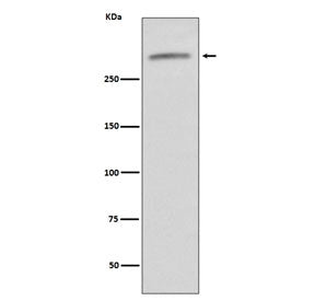 Western blot testing of human serum lysate with von Willebrand Factor antibody. Predicted molecular 