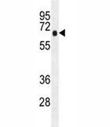 AMPK alpha 1 Antibody / PRKAA1, 0.08ml