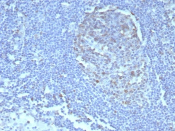 IHC staining of FFPE human tonsil tissue with Caspase 3 antibody (clone CASP3/8446). HIER: boil tiss