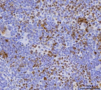 Cdc25b Antibody / M-phase inducer phosphatase 2