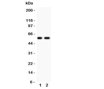 Western blot testing of PIASg antibody and Lane 1: human placenta; 2: A431 lysate. Expected/observed