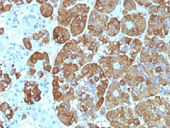 IHC testing of FFPE human pituitary gland with ACTH antibody (clone CLIP/1449). Required HIER: steam