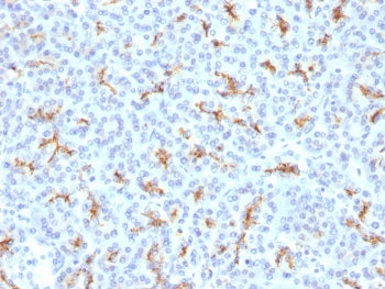 IHC testing of FFPE human pancreas with CFTR antibody. Staining of FFPE tissue is enhanced by boilin