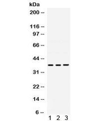 DNA polymerase beta Antibody / POLB