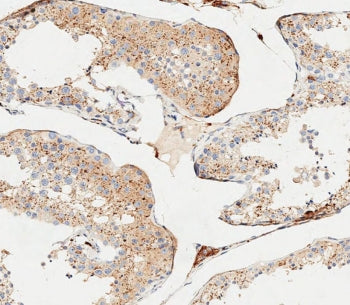 CTSA Antibody / Cathepsin A
