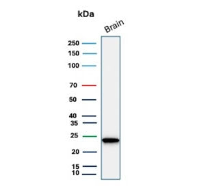 Western blot testing of human brain tissue lysate with UchL1 antibody. Predicted molecular weight ~2