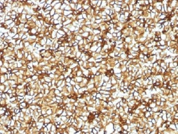 IHC testing of FFPE human pancreas with Spectrin beta III antibody (clone SPTBN2/1582). Required HIE