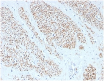 SMMHC Antibody / Smooth Muscle Myosin Heavy Chain