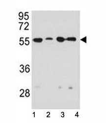Vimentin Antibody
