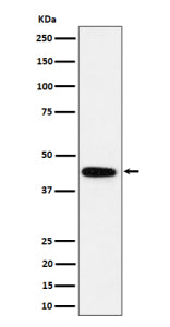 Western blot analysis of GALT expression in human K562 cell lysate using GALT antibody. Predicted mo