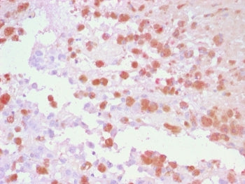 TRP1 / Tyrosinase-Related Protein-1 Antibody