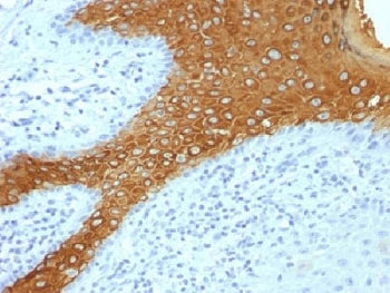 IHC testing of FFPE human skin with Keratin 10 antibody cocktail (KRT10/844). Required HIER: boil ti