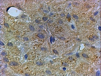 IHC testing of FFPE human liver with PEX13 antibody at 3ug/ml. HIER: steamed with pH6 citrate buffer