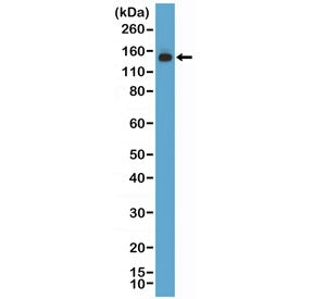Western blot testing of human HEK293 cell lysate with recombinant MSH6 antibody at 1:1000 dilution. 