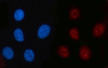 RFC2 Antibody / Replication factor C subunit 2
