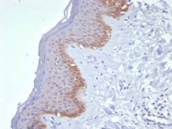 KRT15 Antibody / Cytokeratin 15