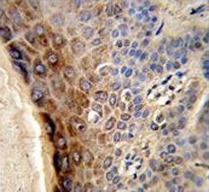 IHC testing of FFPE human skin tissue with CTHRC1 antibody. HIER: steam section in pH6 citrate buffer for 20 min and allow to cool prior to staining.