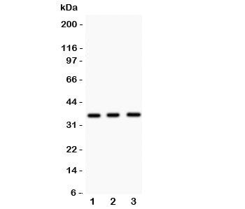 Western blot testing of NKX2.5 antibody and Lane 1: mouse spleen; 2: mouse heart; 3: human HeLa lysa
