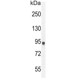 Western blot testing of human MDA-MB-435 cell lysate with IL12RB2 antibody. Predicted molecular weig