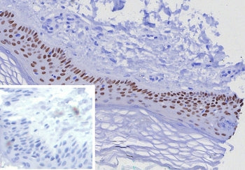IHC staining of FFPE human skin tissue with TP63 antibody (clone TP63/7807R). Inset: PBS used in pla