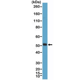 Western blot testing of mouse skeletal muscle tissue with recombinant Myogenin D1 antibody at 1:2000