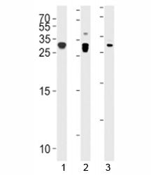 p27Kip1 antibody western blot analysis in 1) A431, 2) HeLa, and 3) mouse C2C12 lysate. Predicted mol