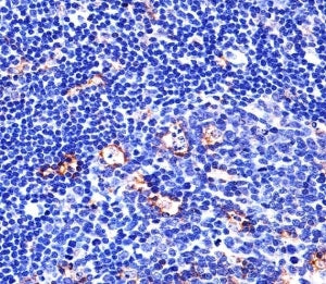 Immunohistochemical analysis of paraffin-embedded human tonsil using Integrin beta 2 antibody at 1:2