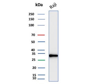 Western blot testing of human Raji cell lysate with CD20 antibody. Predicted molecular weight ~33 kD