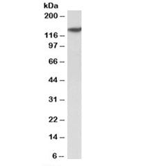 Western blot testing of human spleen lysate with SP140 antibody at 2ug/ml. Expected molecular weight