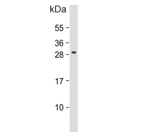 Western blot testing of human MOLT4 cell lysate with ALKBH6 antibody. Predicted molecular weight ~26