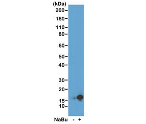 Western blot of acid extracts from HeLa cells untreated (-) or treated (+) with sodium butyrate usin