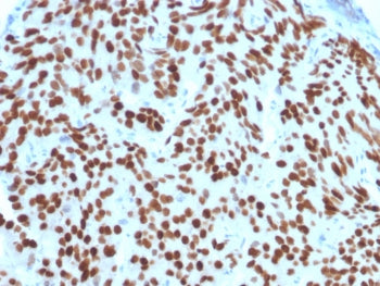 NKX3.1 Antibody
