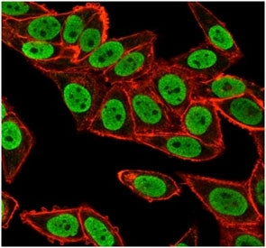 Immunofluorescent staining of PFA-fixed human HeLa cells using Chk2 antibody (green, clone PCRP-CHEK2-1A4) and phalloidin (red).
