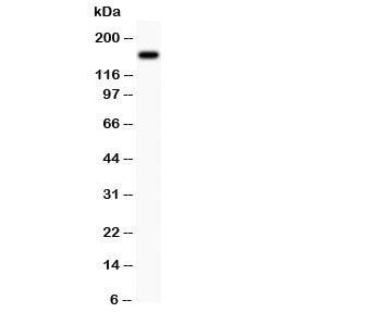 MAP3K1 Antibody (MEKK1)