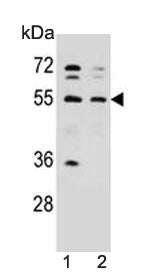 Western blot testing of human 1) WiDr and 2) HepG2 cell lysate with NARS antibody. Predicted molecul