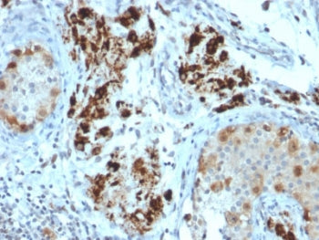 IHC staining of FFPE human adrenal gland with StAR antibody (clone STAR/2154). Required HIER: boil t