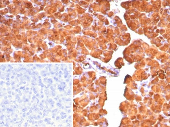 Carboxypeptidase A1 Antibody / CPA1