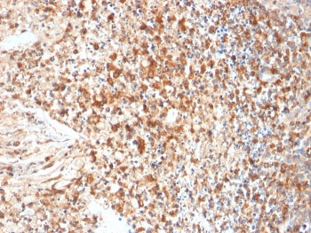 HSV1 Antibody / Herpes Simplex Virus Type I