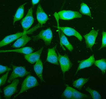 Western blot testing of human 1) HeLa and 2) COLO320 cell lysate with JNK2 antibody. Expected/observ