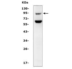 Western blot testing of mouse kidney tissue lysate with SLC9A2 antibody. Expected molecular weight ~