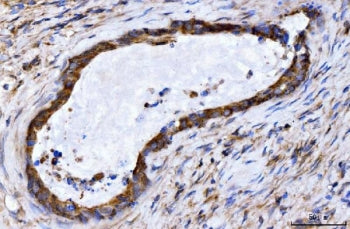 GIGYF2 Antibody