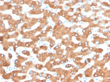 Haptoglobin Antibody