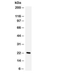Western blot testing of human HeLa cell lysate with GCSF antibody. Expected/observed molecular weigh